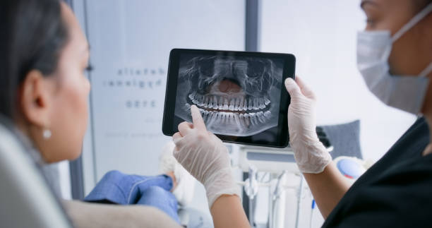 Licensed Dental Implants service in Minden, LA - Smile Center Dentistry